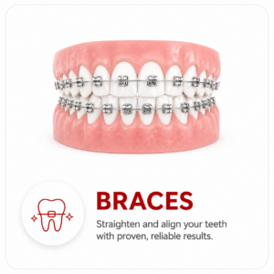 braces